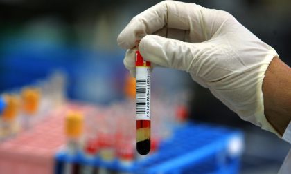 Test del sangue per scovare 4 tipi di tumori