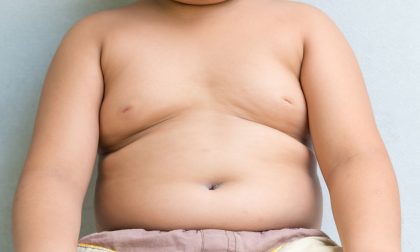 Nel 2022 più bambini obesi che sottopeso