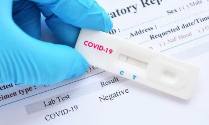 Vaccino Covid, da gennaio 2021 a marzo 2022 arriveranno 202 milioni di dosi