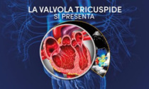 "La valvola tricuspide si presenta"