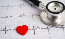 Malattie cardiovascolari: anche a Novara la giornata di prevenzione