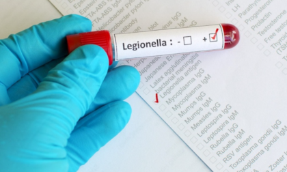 Legionella: palestra chiusa a Vignale ma "situazione sotto controllo"